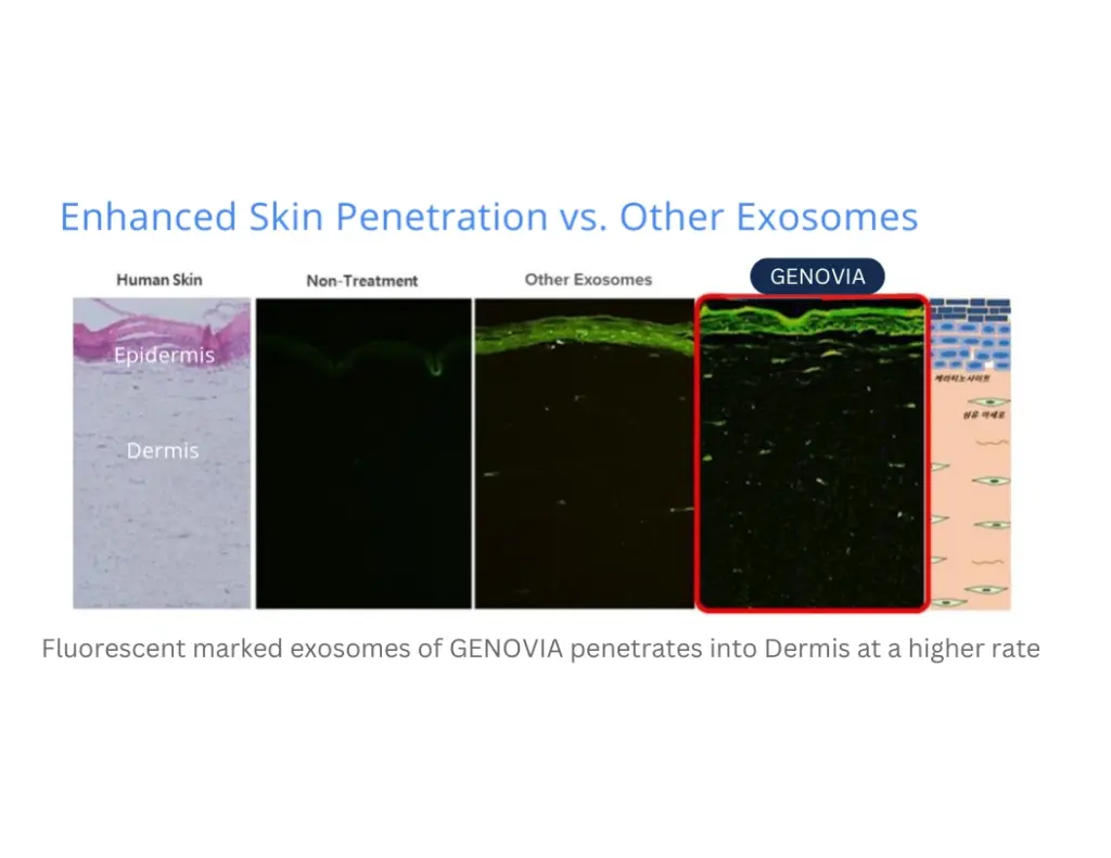 Enhanced Skin Penetration vs. Other Exosomes Chart