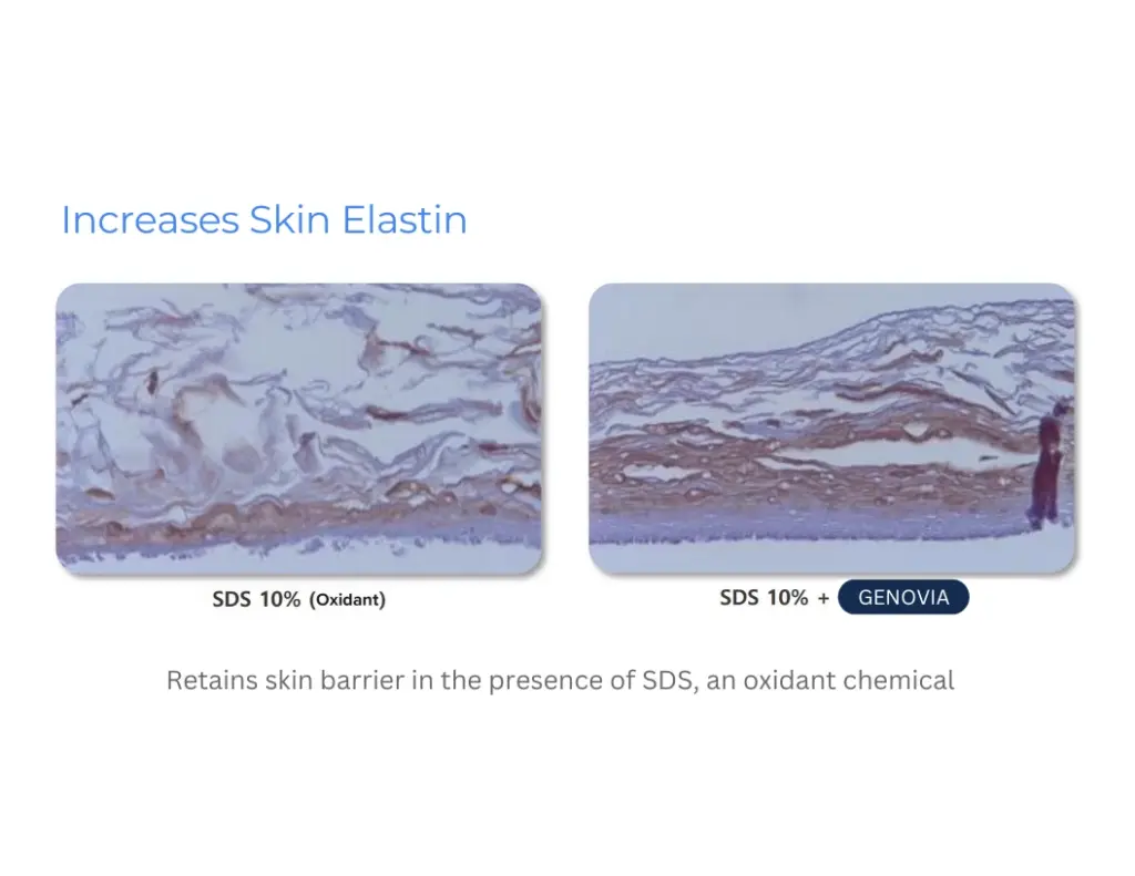 Enhances Skin Elastin Chart