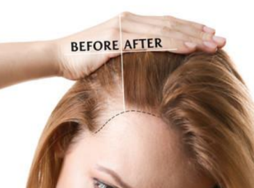 a34c4233e206fd705659bbdcb41499e384ad5bc2